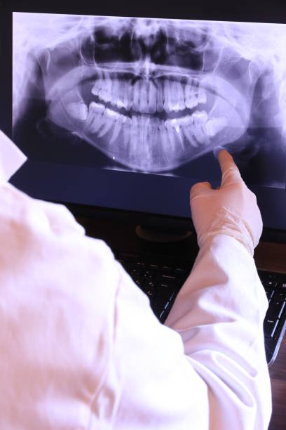 Best Emergency Root Canal Therapy in Duson, LA