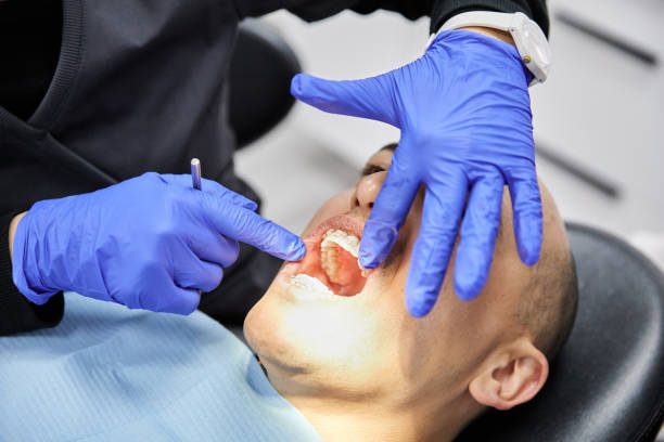 Best Emergency Treatment for Oral Infections in Duson, LA