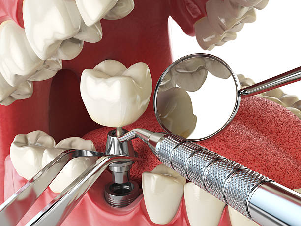 Best Emergency Care for Gum Disease in Duson, LA